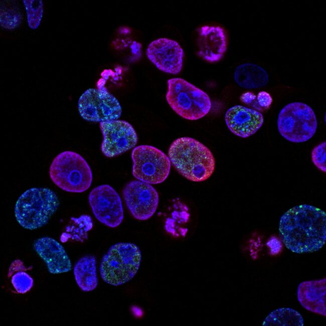 nanocarreadores-national-cancer-institute-L7en7Lb-Ovc-unsplash