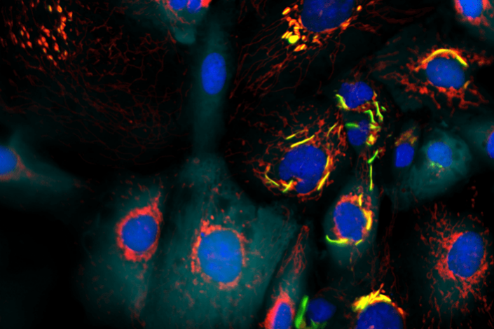 Pesquisa-do-CNPEM-elucida-primeira-estrutura-de-enzima-dentro-da-mitocondria