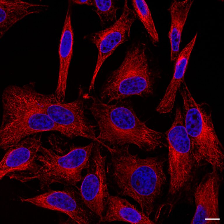 LIB-Microscopia de super resolução de Célula humana com núcleo marcado em azul e citoesqueleto em vermelho