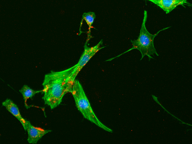 1-fibroblasto-microscopia-de-fluorescencia-de-campo-amplo