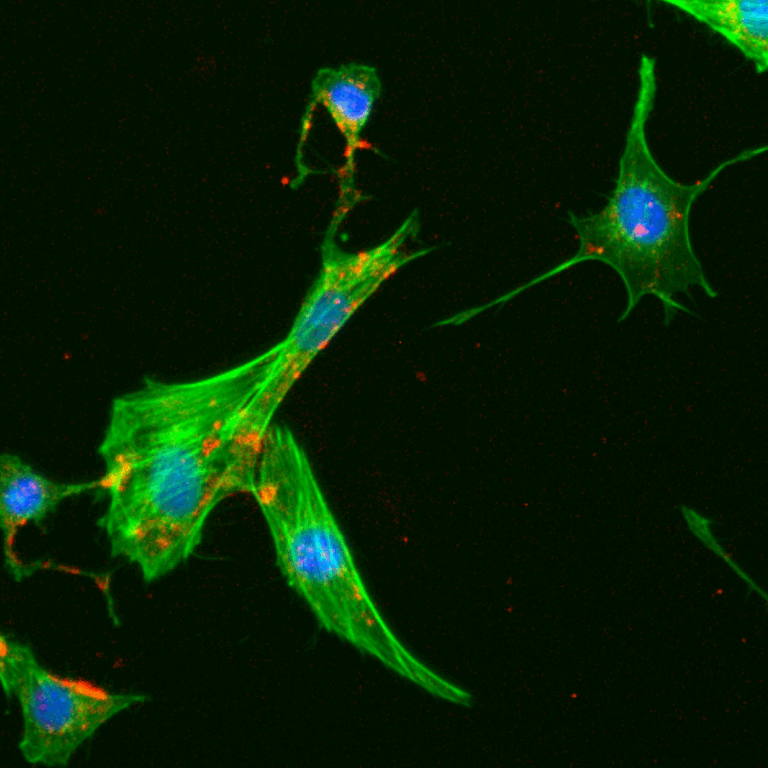 1-fibroblasto-microscopia-de-fluorescencia-de-campo-amplo